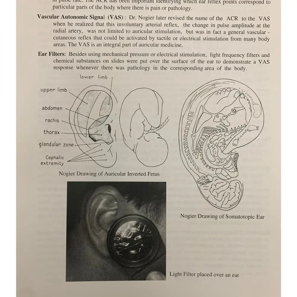 Auriculotherapy Manual: Chinese and Western Systems of Ear Acupuncture - Oleson